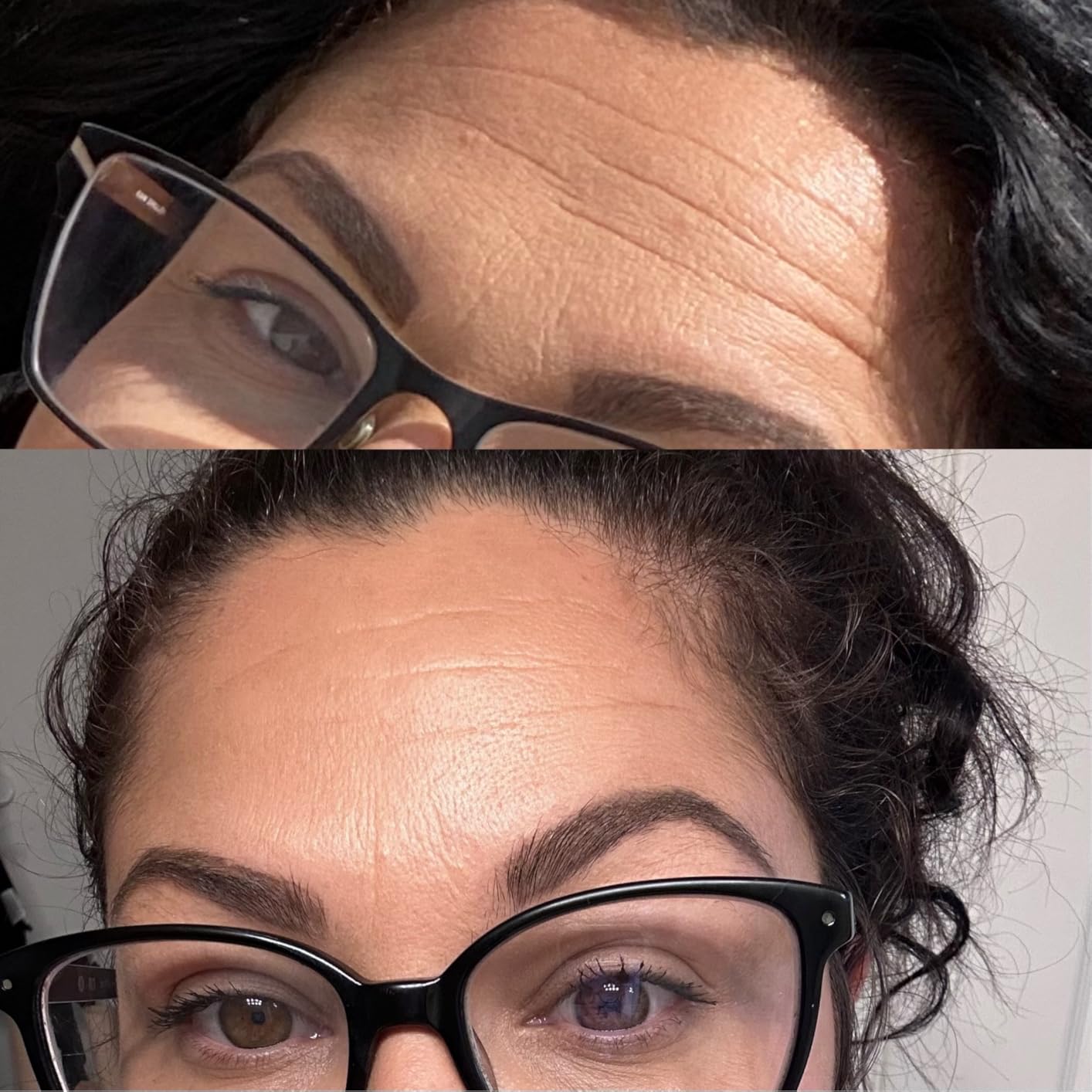 RoC Retinol Correxion Deep Wrinkle Retinol Face Serum, Ascorbic Acid, 1 0z customer photo 1
