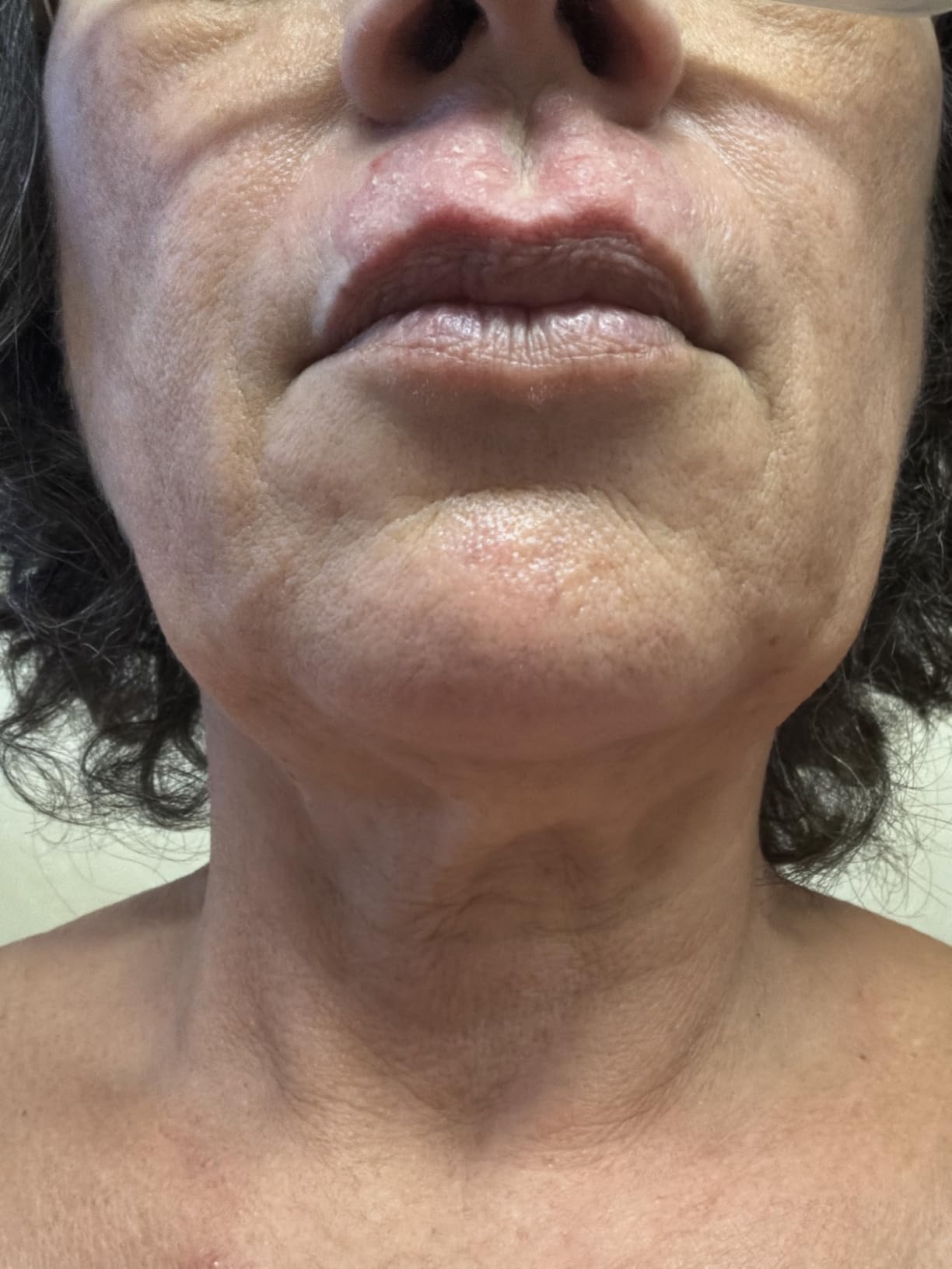La Roche-Posay Anthelios Mineral Light Fluid Sunscreen for Face in 5 shades customer photo 1