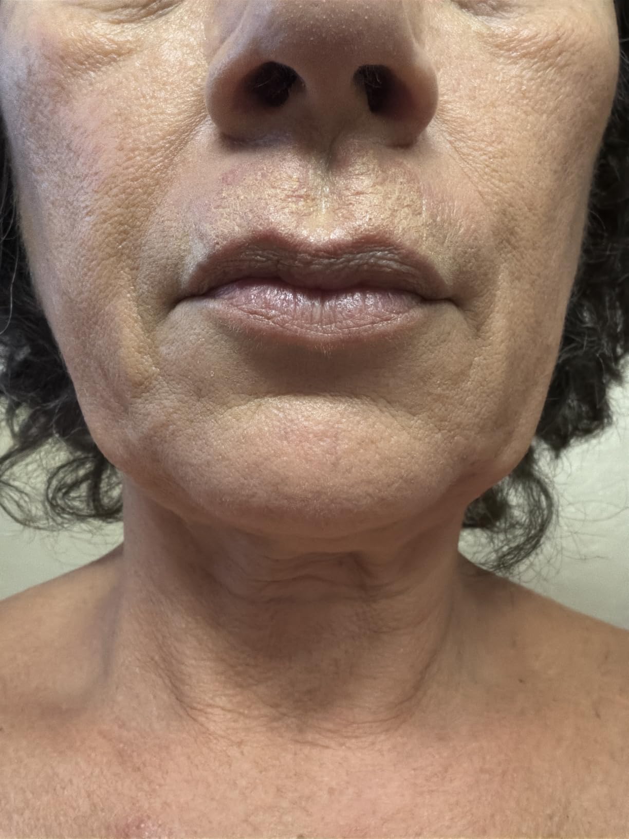 La Roche-Posay Anthelios Mineral Light Fluid Sunscreen for Face in 5 shades customer photo 2