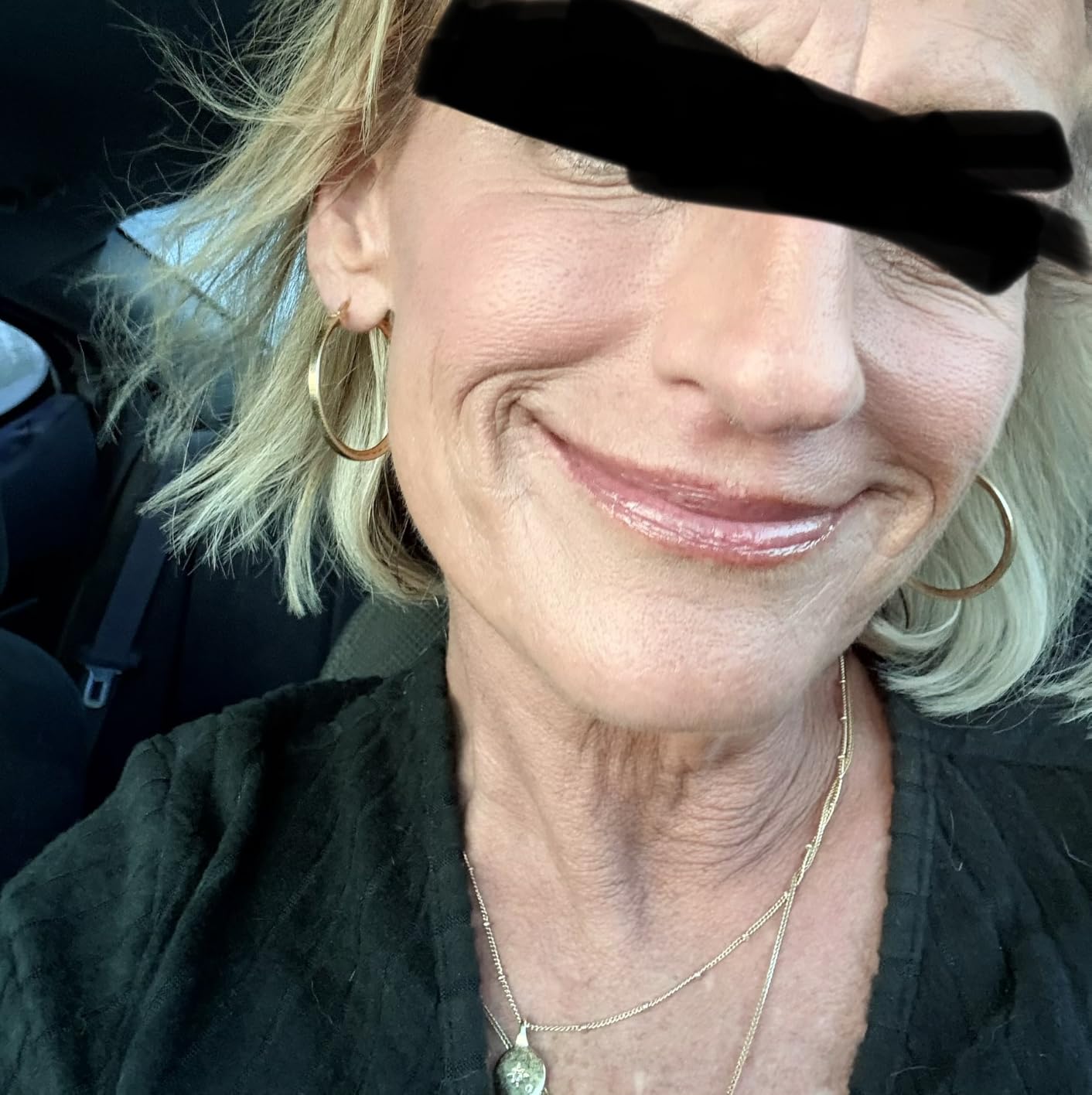 Hyaluronic Acid Serum for Skin 100% Pure Anti Aging Intense Hydration Moisture Non greasy Paraben free, Wrinkle Reducing and Brightening Serum (Pro Formula) 2oz customer photo 1