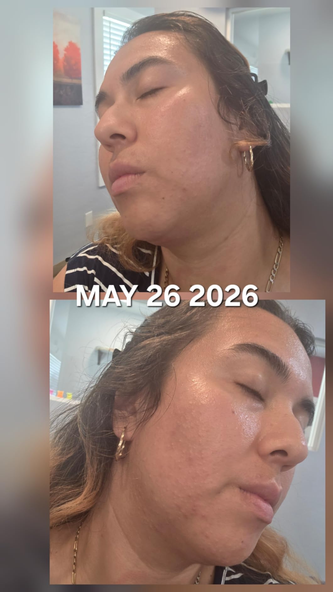 Paula's Choice SKIN PERFECTING 2% BHA Liquid Exfoliant customer photo 2