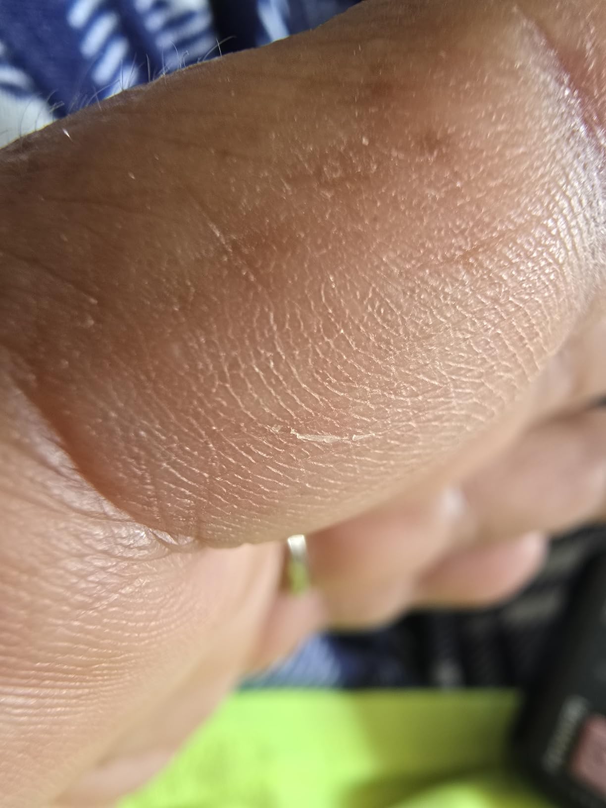 CeraVe Therapeutic Hand Cream, Hyaluronic Acid & Niacinamide Lotion, 3oz customer photo 1