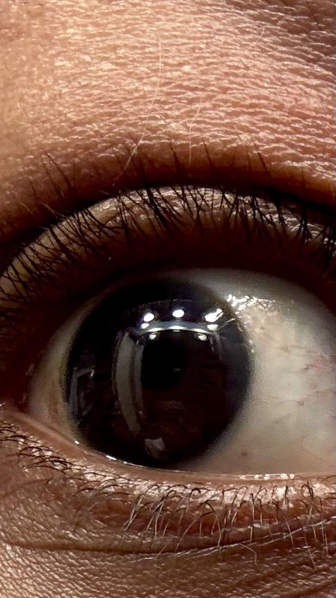 RapidLash Eyelash Enhancing Serum - 2 Month Supply, 3mL customer photo 1