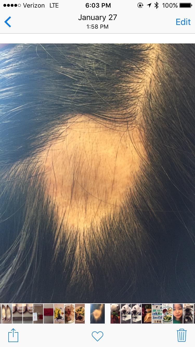 Hair Growth Vitamins for Women & Men - 5000mcg Biotin, 11 Ingredients customer photo 2