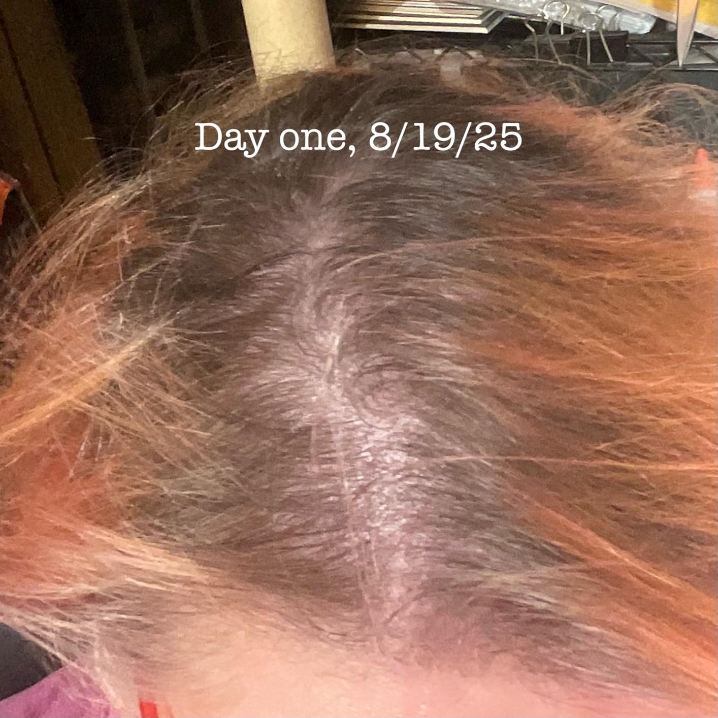 Rosemary and Biotin Shampoo for Thinning Hair - Vegan Volumizing Shampoo for Fine Hair with B Vitamins Argan Oil & Tea Tree Essential Oil - Paraben Silicone and Sulfate Free Vegan Formula (8 Fl Oz) customer photo 1