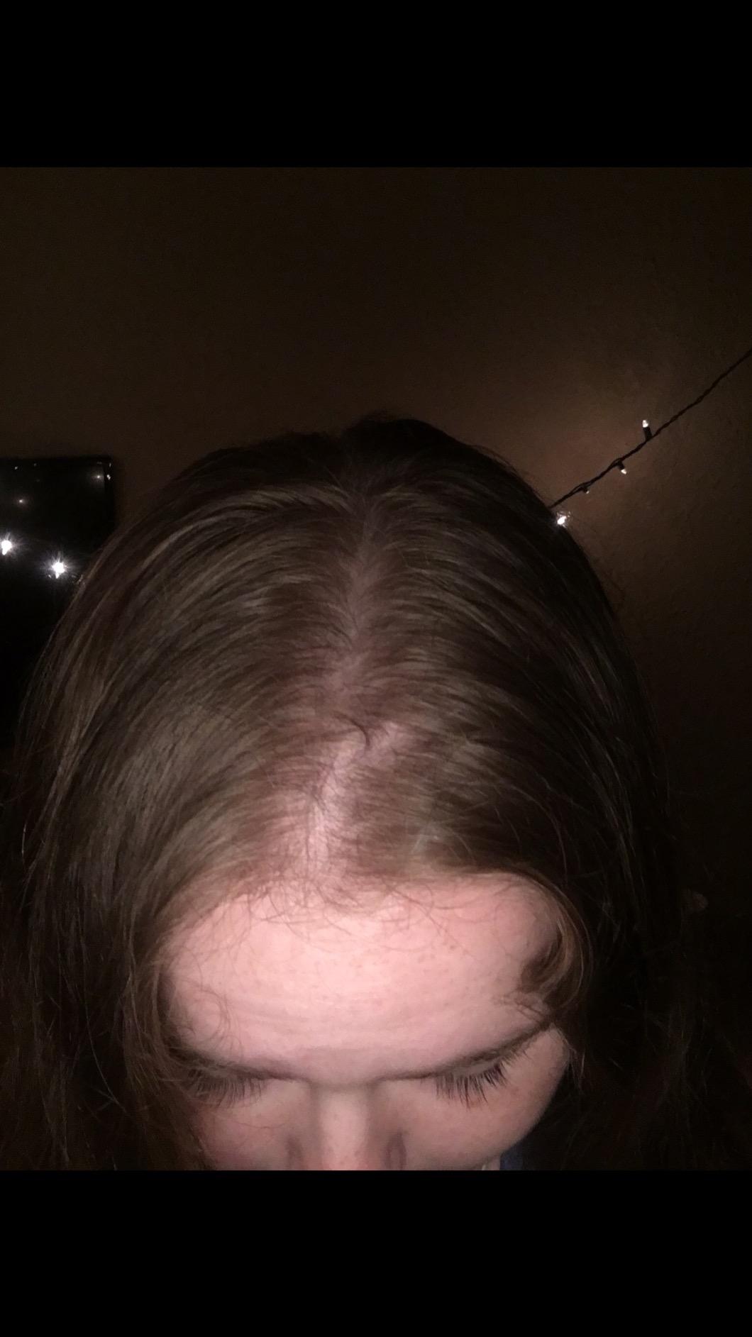 Rosemary and Biotin Shampoo for Thinning Hair - Vegan Volumizing Shampoo for Fine Hair with B Vitamins Argan Oil & Tea Tree Essential Oil - Paraben Silicone and Sulfate Free Vegan Formula (8 Fl Oz) customer photo 2