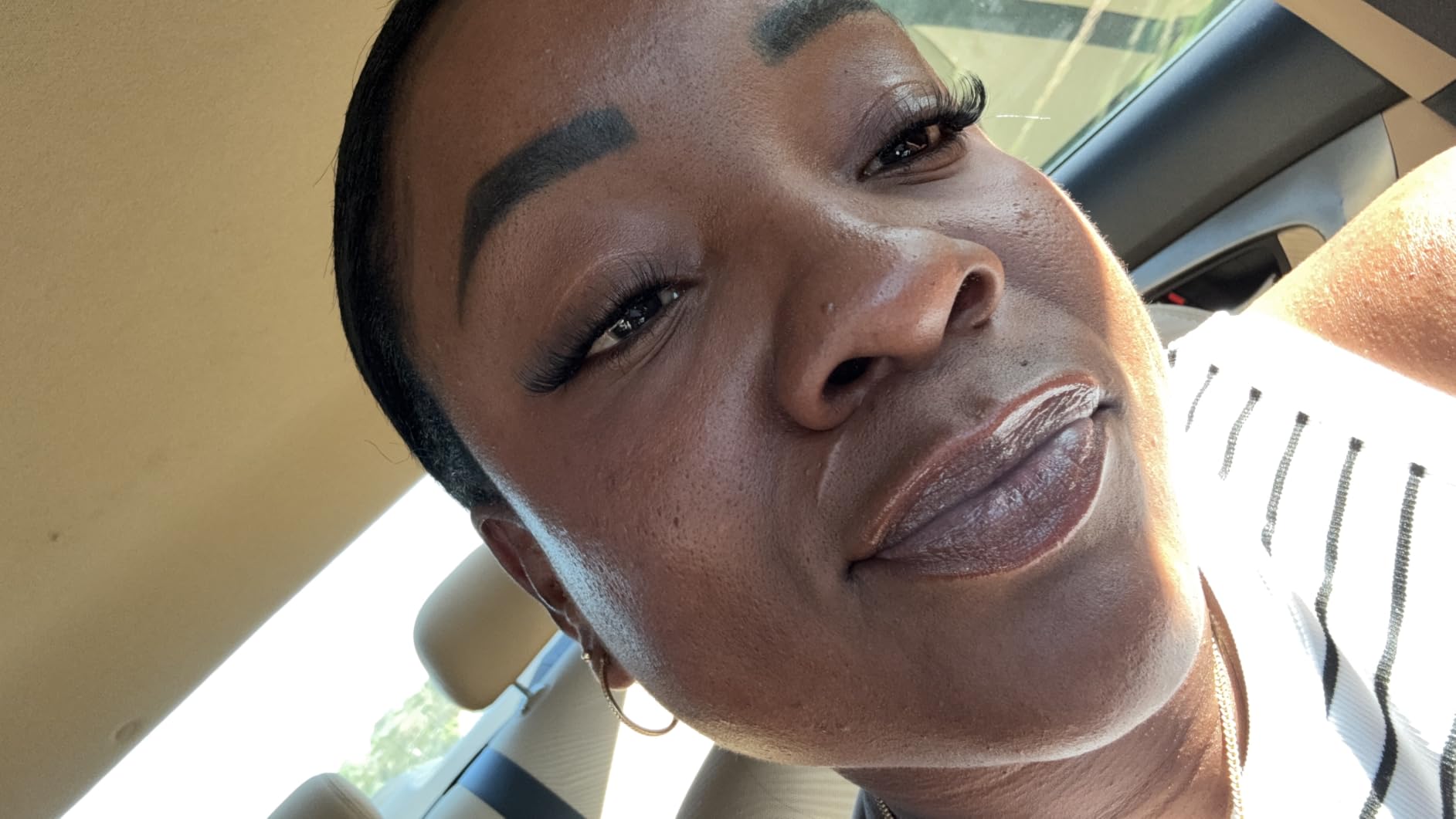The Ordinary Niacinamide 10% + Zinc 1%, Smoothing Serum for Blemish-Prone Skin customer photo 2