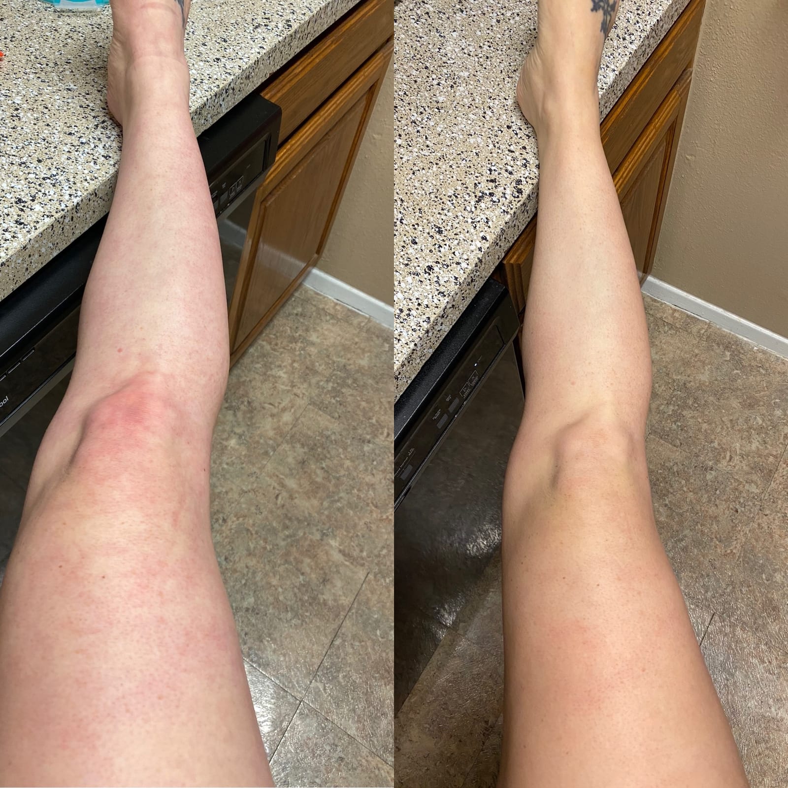 L'Oreal Paris Sublime Bronze Self Tanning Water Mousse, Streak-Free Natural Looking Tan, 5 fl. Oz customer photo 2