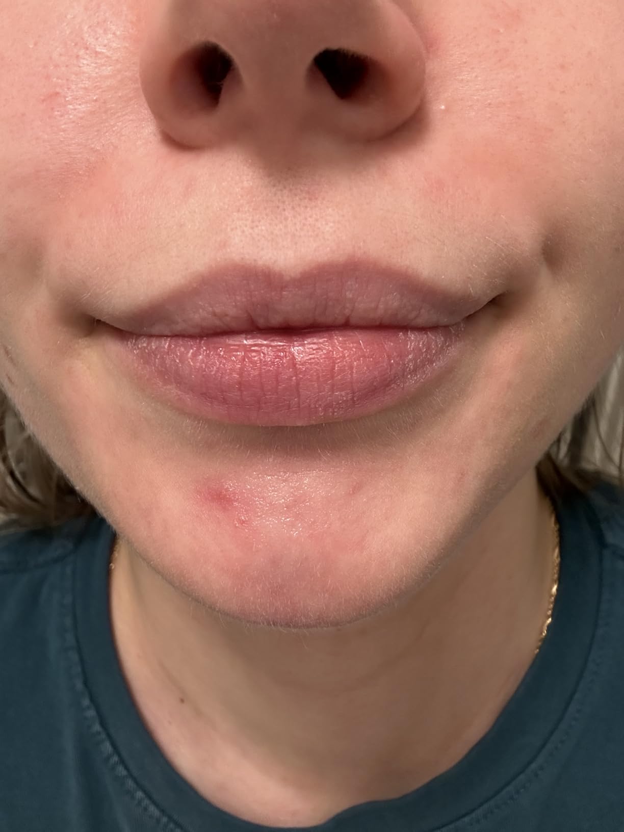 O'Keeffe's Lip Repair Unscented Balm, 2-Pack customer photo 2