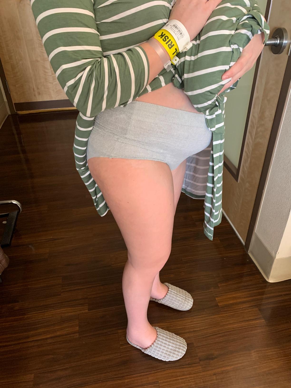 Frida Mom Postpartum Underwear for C-Section Recovery, Disposable High Waist with Stretch Support customer photo 1