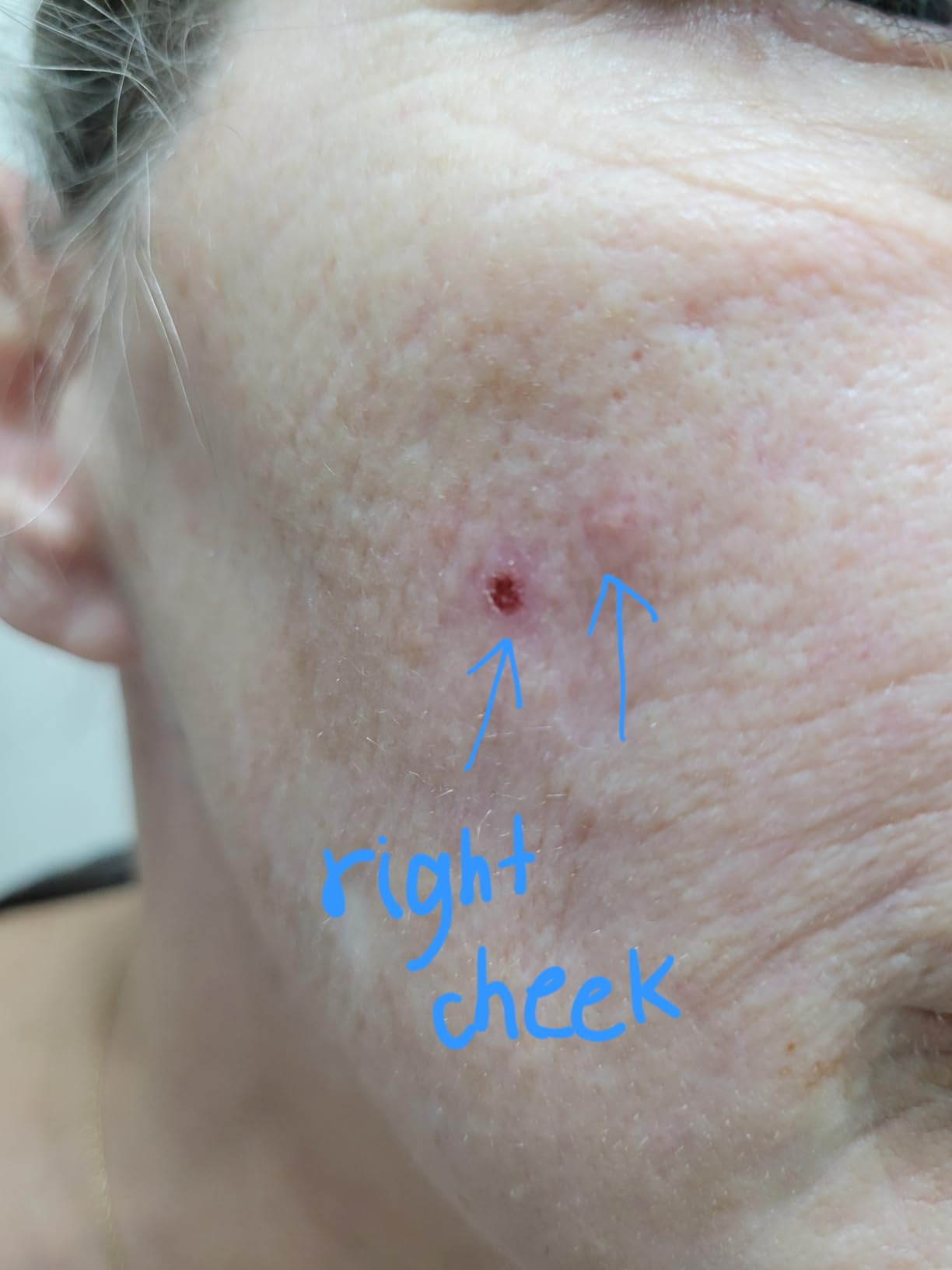 CeraVe Resurfacing Retinol Face Serum with Niacinamide, Pore Minimizer, 1oz | Skin Care Brightening Serum with Licorice Root, Acne Scar & Hyperpigmentation Treatment, Dark Spot Corrector, Skin Repair customer photo 2