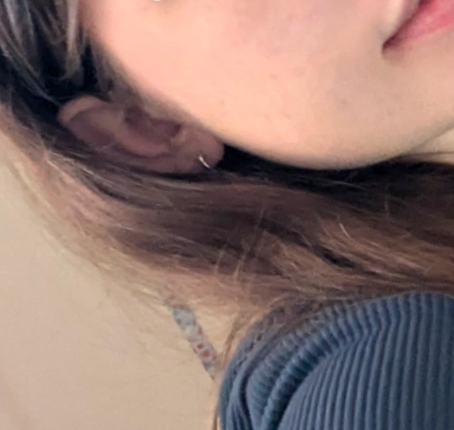 CeraVe Foaming Acne Cream Cleanser, Face Wash with 4% Benzoyl Peroxide, 5oz customer photo 1