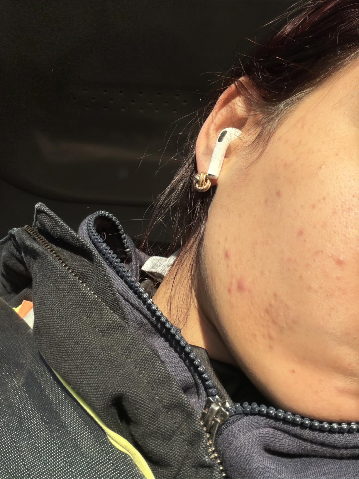 Paula's Choice CLINICAL 20% Niacinamide Vitamin B3 Face Serum, 0.67 Fl Oz customer photo 1