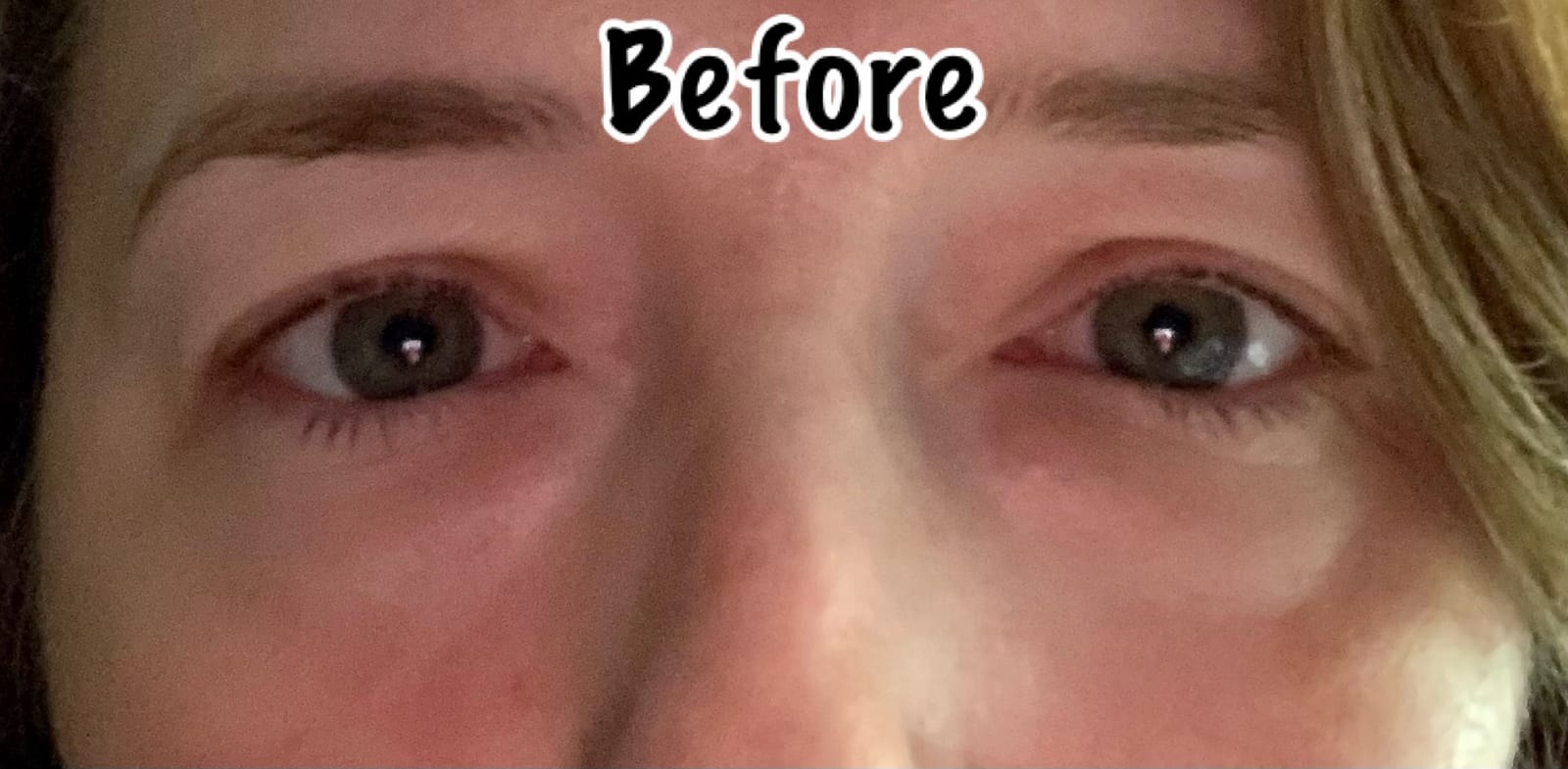 Under Eye Patches (20 Pairs) - Eye Patches For Puffy Eyes And Dark Circles - Under Eye Mask For Beauty & Personal Care - Under Eye Mask Amino Acid & Collagen For Dark Circles And Puffiness by Celor customer photo 1