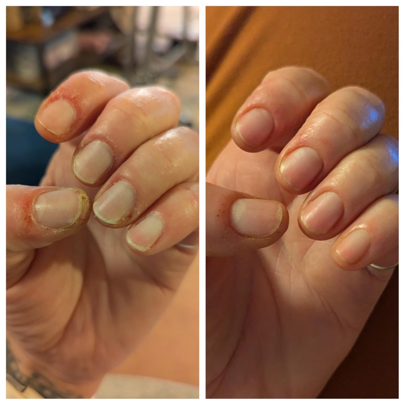 Onsen Nail & Cuticle Cream Treatment w/Japanese Tsubaki, Jojoba & Lavender Oil, Shea Butter – Strengthens Nails, Softens Cuticles - Daily Repair Care (1 Count/15 ml) customer photo 1