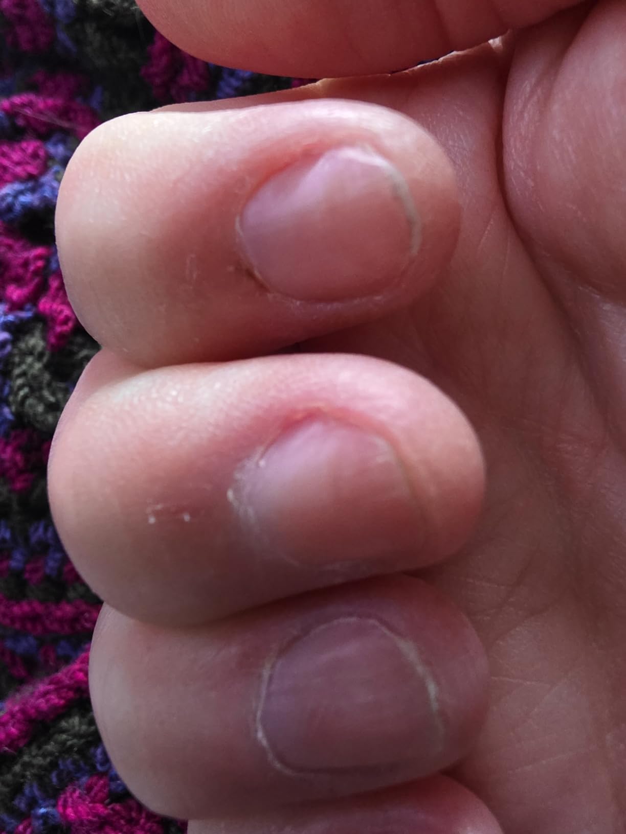 Onsen Nail & Cuticle Cream Treatment w/Japanese Tsubaki, Jojoba & Lavender Oil, Shea Butter – Strengthens Nails, Softens Cuticles - Daily Repair Care (1 Count/15 ml) customer photo 2