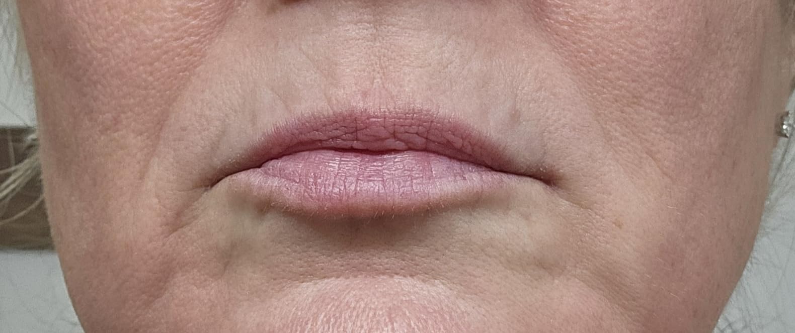 City Beauty City Lips Clear - Plumping Lip Gloss - Hydrate & Volumize - High Shine Lip Plumper - Hyaluronic Acid & Peptides Visibly Smooth Lip Wrinkles - Cruelty-Free customer photo 1