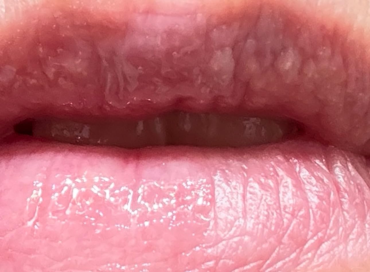 City Beauty City Lips Clear - Plumping Lip Gloss - Hydrate & Volumize - High Shine Lip Plumper - Hyaluronic Acid & Peptides Visibly Smooth Lip Wrinkles - Cruelty-Free customer photo 2