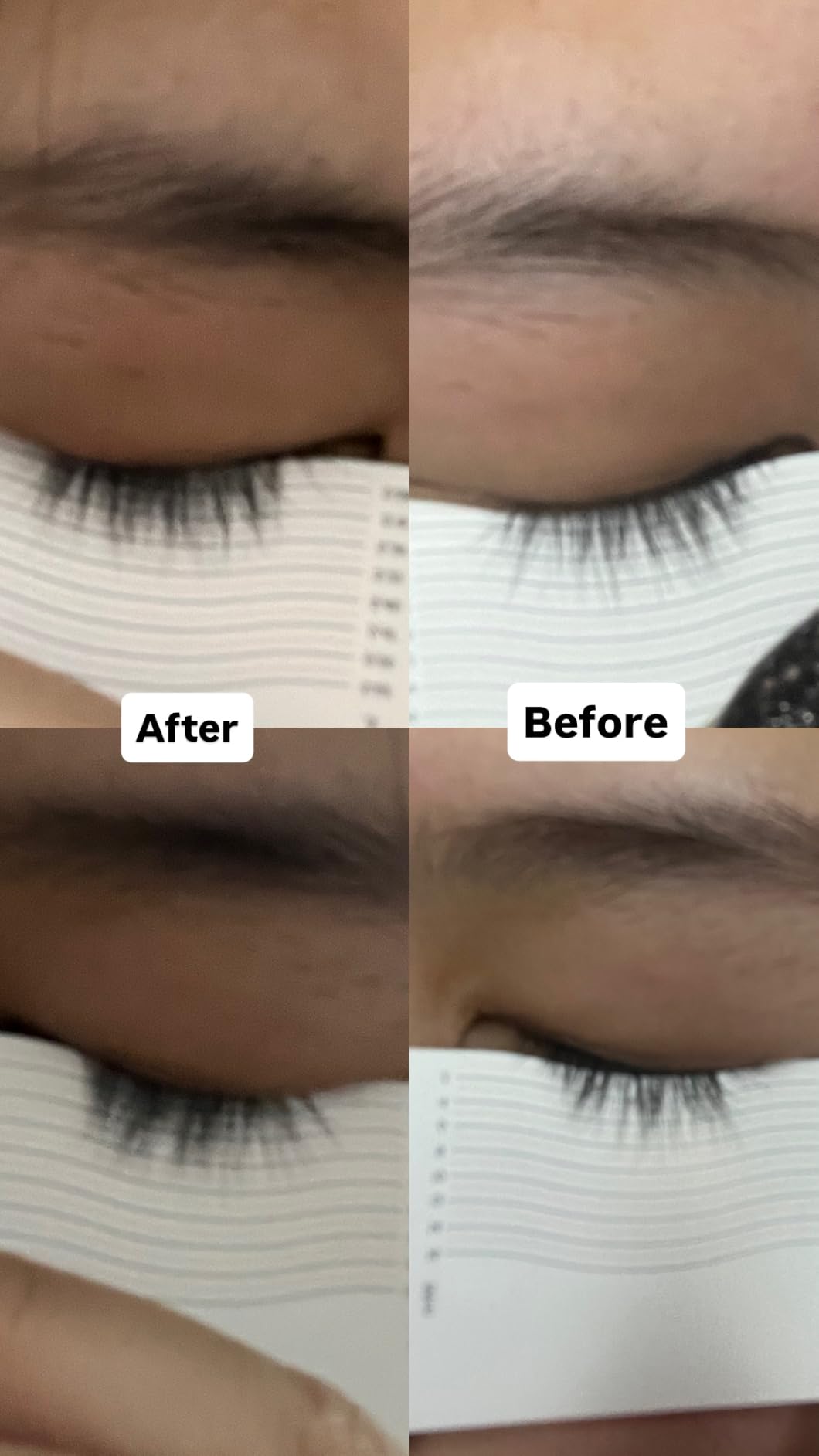 ForChics Prostaglandin-Free Eyelash Growth Serum – Rebuilds Thin Lashes customer photo 1