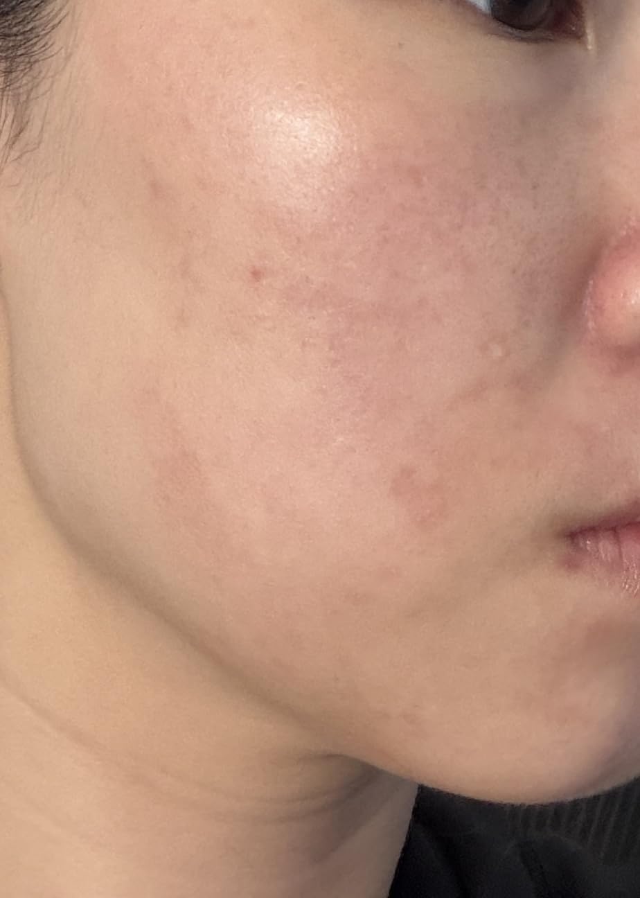 AESTURA ATOBARRIER365 Cream with Ceramides, Korean Face Moisturizer for Barrier Repair | 120H lasting Hydration, Ceramide Capsules, Dry & Sensitive Skin, Non-comedogenic, 80 mL / 2.70 fl.oz. customer photo 2