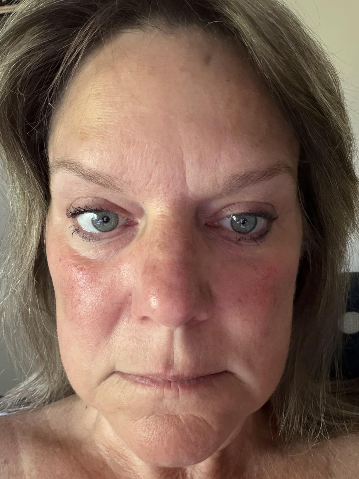 Enaskin Naturals Under Eye Patches for Puffy Eyes & Dark Circles 60 Patches customer photo 1