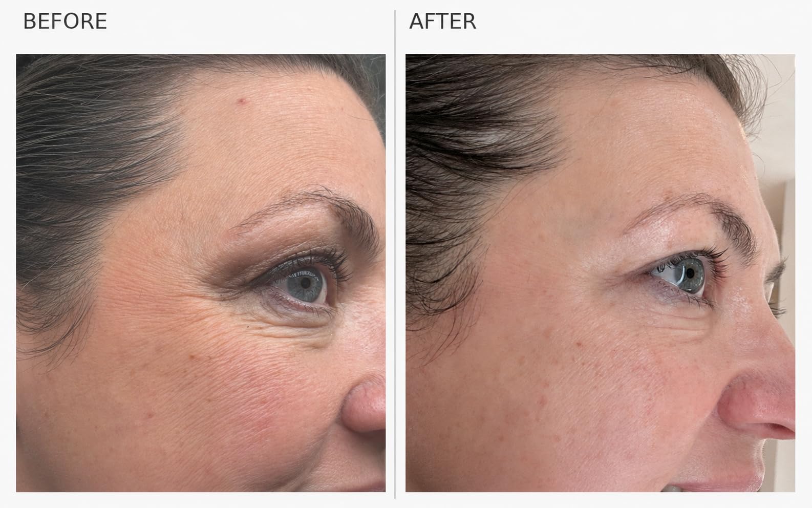 COSRX 7X Ceramide Moisturizer for Face, Barrier Repair Face Cream, 2.7oz customer photo 2