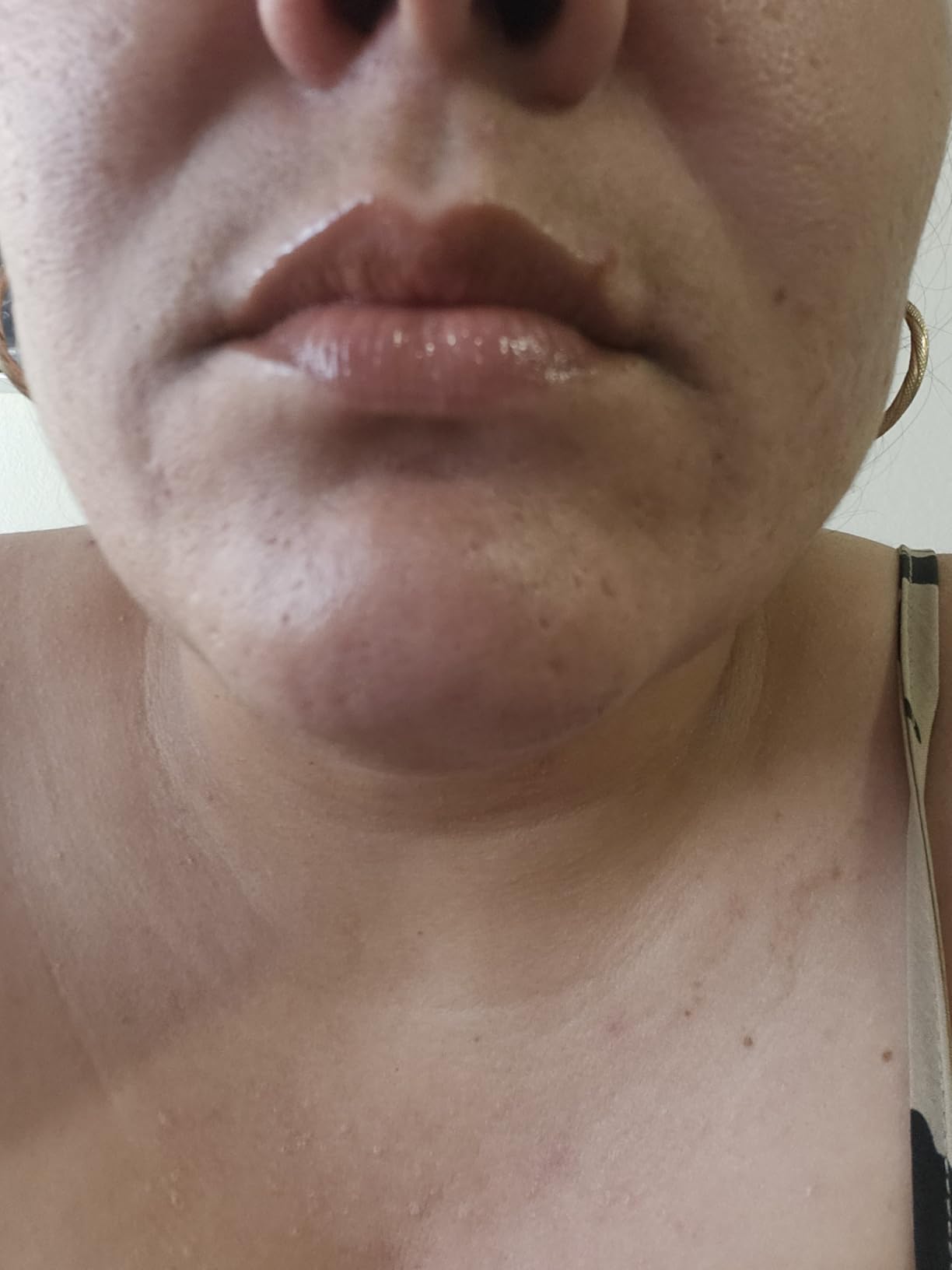 RoC Derm Correxion Lip Volumizer, Hyaluronic Acid Lip Plumper Serum 0.34oz customer photo 1