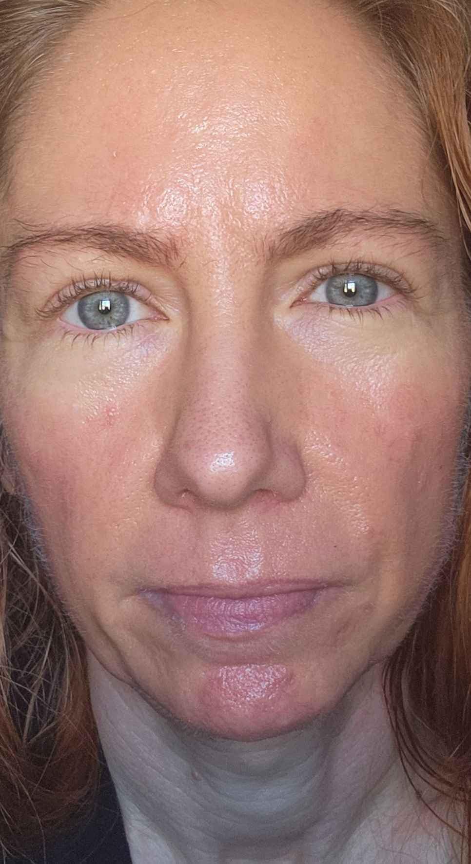 First Aid Beauty Ultra Repair Cream, Intense Hydration - Clinically Tested Face & Body Moisturizer with Colloidal Oatmeal - Supports Eczema & Dry Skin Barrier Repair - Fragrance Free customer photo 1